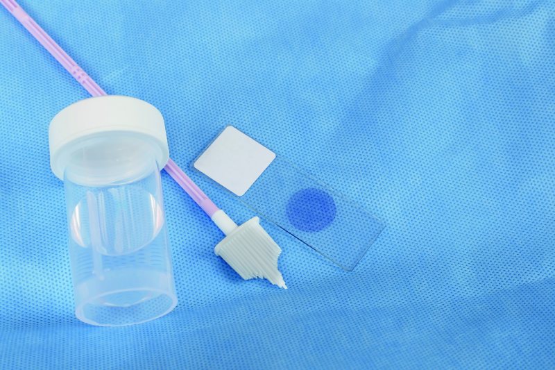 routine follow up در آزمایش پاپ اسمیر چیست ؟