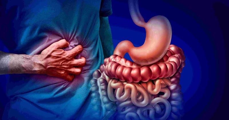 کاربرد قرص مبورین برای سندروم روده تحریک‌ پذیر