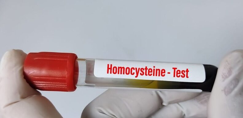 کاهش سطح هموسیستئین سبب کاهش چه خطری میشود؟
