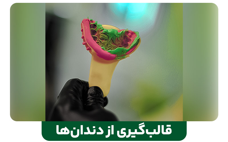 ارتودنسی نامرئی بهتر است یا سیمی ؟
