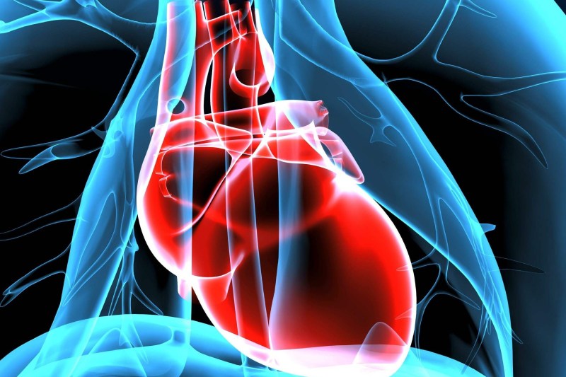 فناوری جدید برای درمان سکته قلبی؛ پچ هیدروژلی که قلب را ترمیم می‌ کند