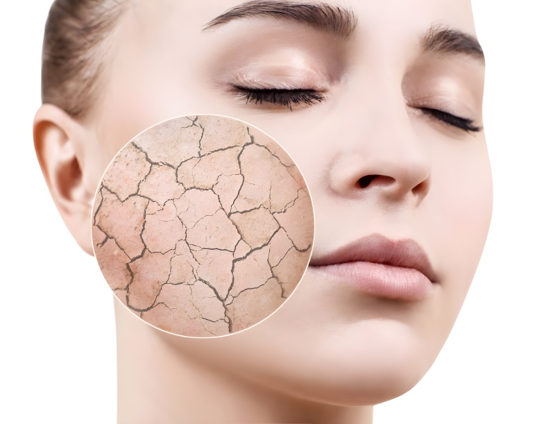 پوست خشک یا کم‌ آب؟ علل، تفاوت ها و روش‌ های موثر برای بازگرداندن شادابی پوست