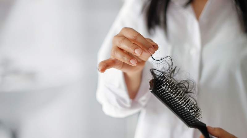 ۴ روش ساده برای کاهش ریزش مو و حفظ سلامت موها