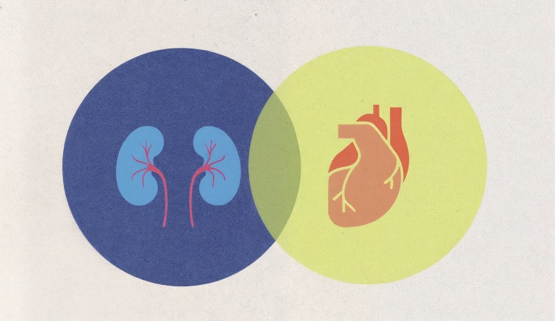سندروم قلبی، کلیوی و متابولیک؛ بیماری پنهانی که زندگی ۹۰ درصد افراد را تهدید می کند