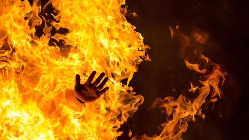 پیشگیری از سوختگی در فصل زمستان؛ راهکارهای ایمنی و توصیه های پزشکی