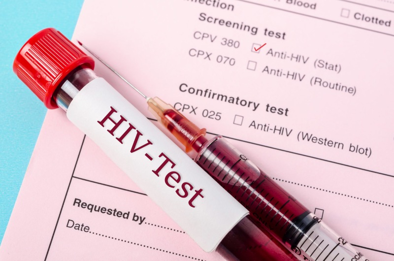 گروه‌ های پر خطر برای ابتلا به ایدز؛ چه کسانی باید آزمایش بدهند؟