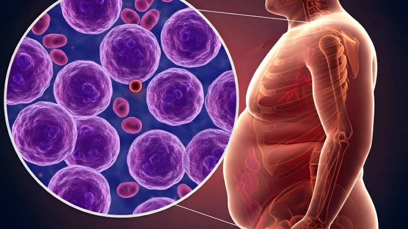 چاقی و افزایش خطر ابتلا به بیماری های عفونی